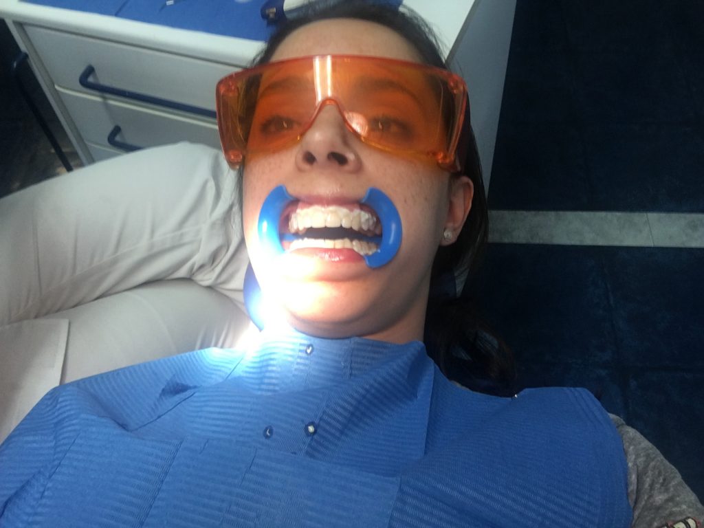 Mi blanqueamiento dental en clínica